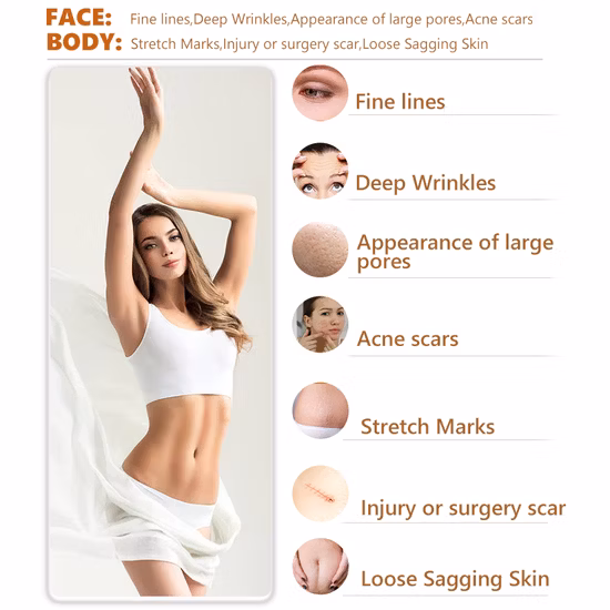 最も効果的な高周波セルライト燃焼。  5 in 1 超音波真空キャビテーション、V9 キャビテーション、RF サクションローラー、ボディ痩身